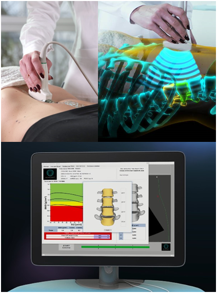 The EchoS system is FDA-cleared in the United States and is designed to assess bone mineral density at the lumbar spine and femoral neck.