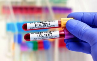 You’ve had your cholesterol checked, opened the results, and found yourself looking at a collection of numbers and abbreviations. Perhaps your LDL is a little high. Your HDL looks good. Your triglycerides fall somewhere in between. So, how concerned should you be? The answer depends on how those numbers fit into your overall health.